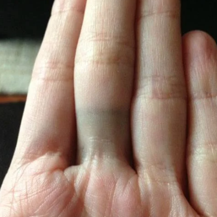 Unglaubliche Möglichkeiten, um zu verhindern, dass ein Ring Ihren Finger grün verfärbt